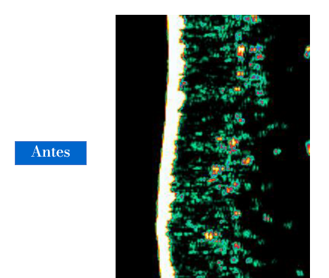 ANTES